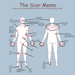 Scars meme