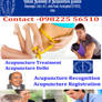 Acupuncture Migraine Treatment