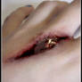 bloody wound full