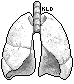 [Monochrome] Lungs