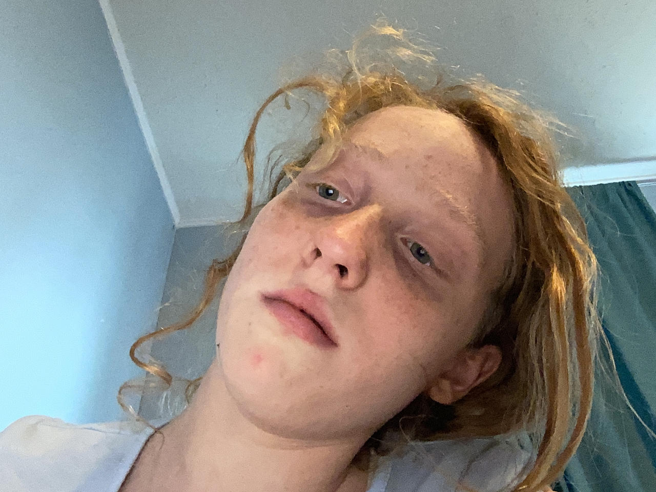 All my face freckles by agentxsketcher on DeviantArt