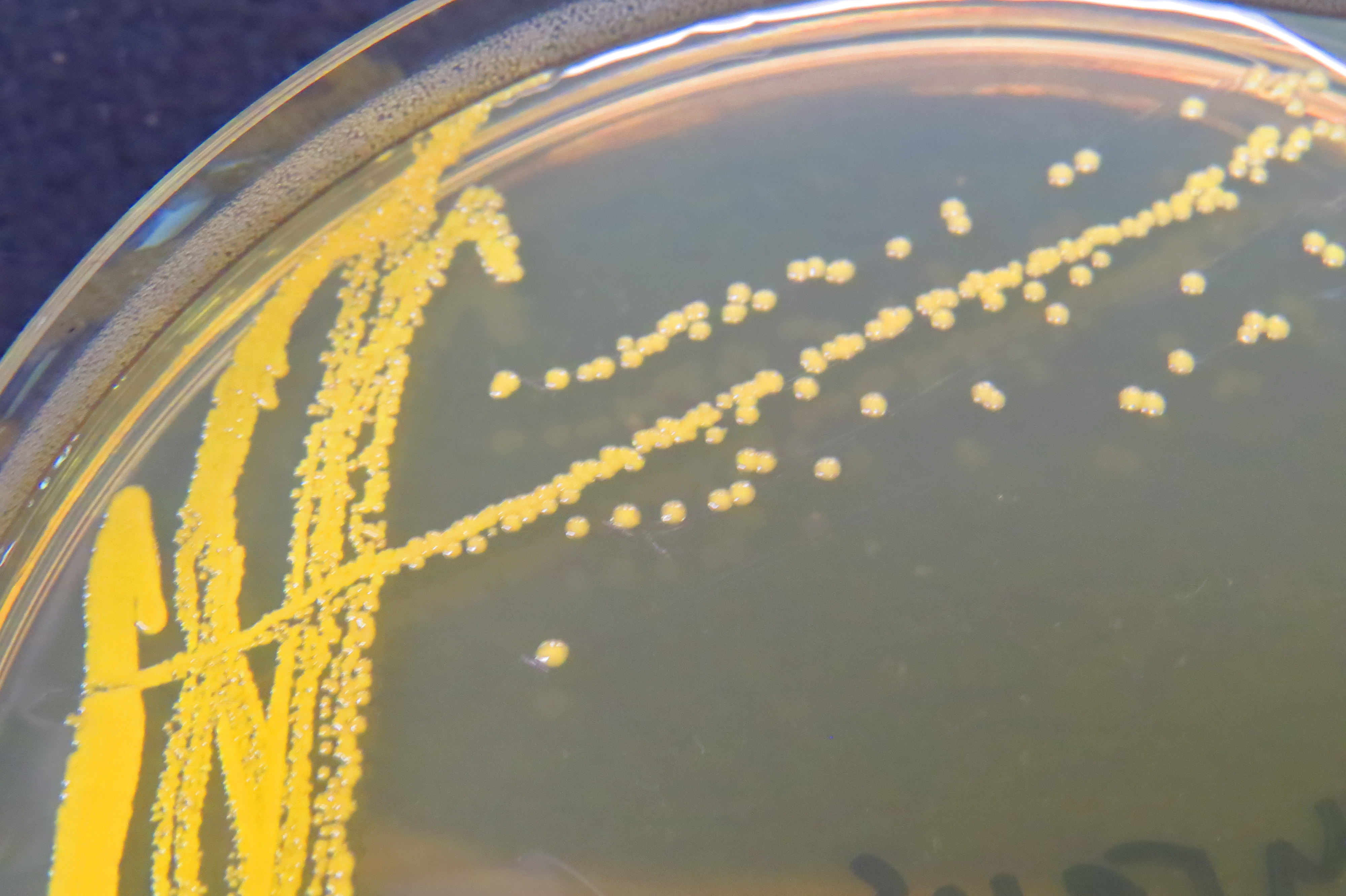 Staphylococcus aureus среда. Золотистый стафилококк на ЖСА. Citreus стафилококк. Колонии стафилококков на ЖСА. Стафилококк сапрофитикус.