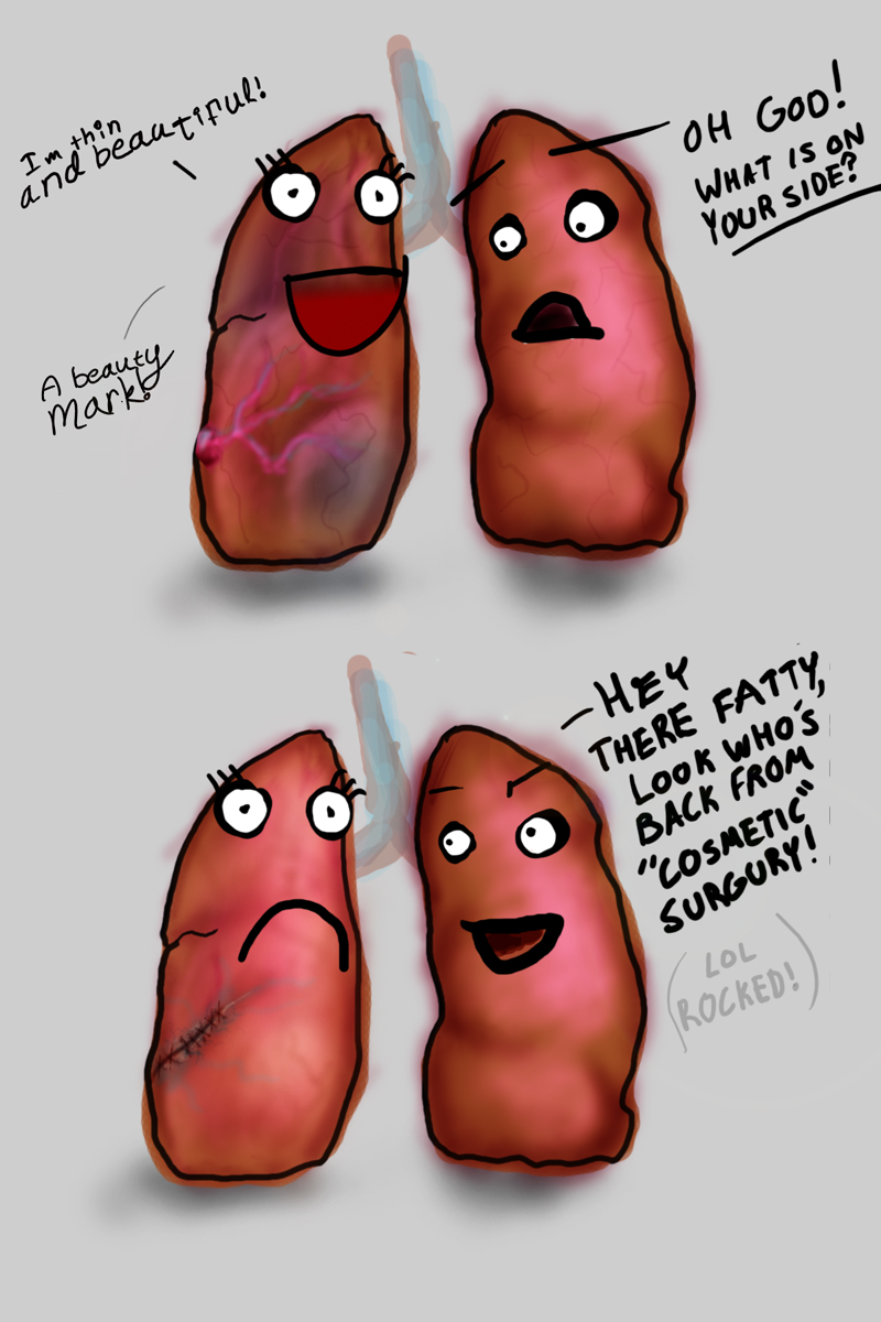 Erik's Lungs