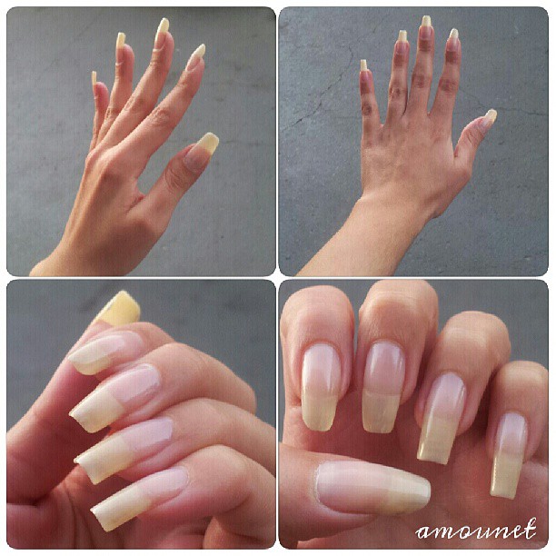 Natural nails