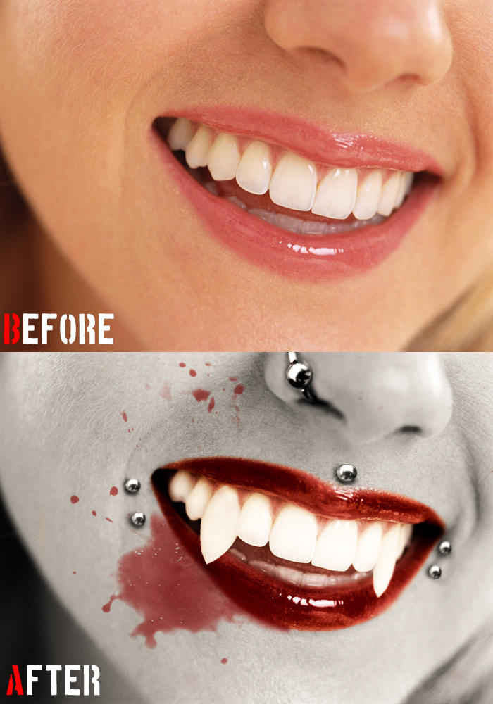 Vampire Smile Comparison