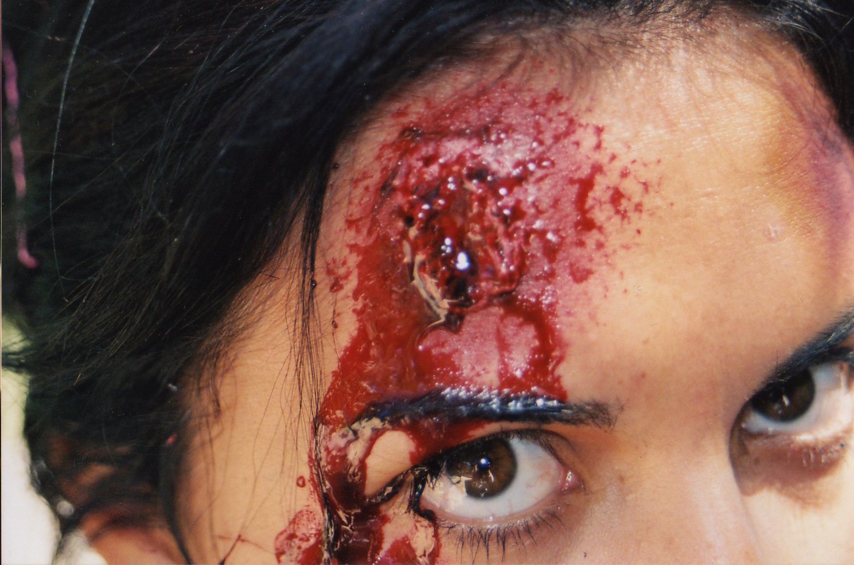 'Natalie's' head wound closeup