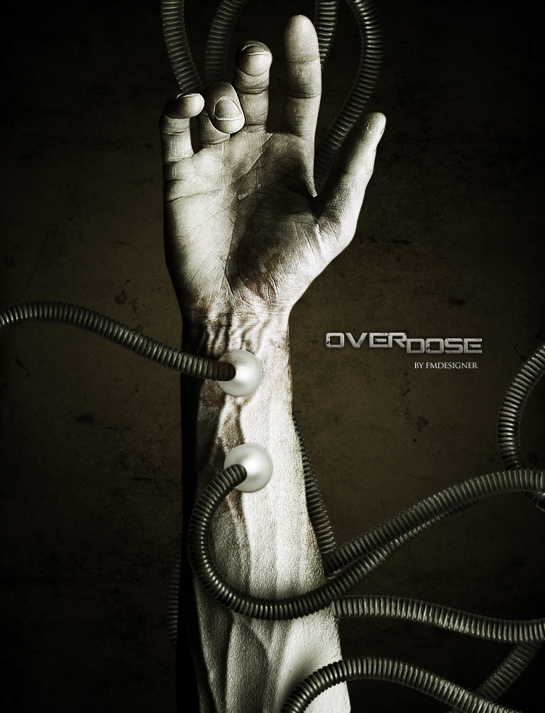 Overdose