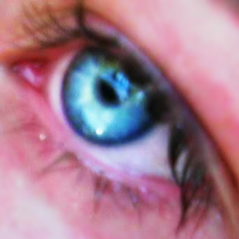 Blue eye