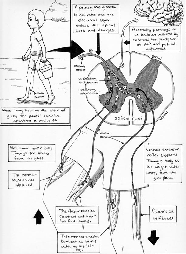 Crossed Extensor Reflex pg 2 by Nightmare-Bug on DeviantArt