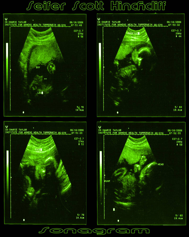 Baby Sonogram by zodiacus on DeviantArt