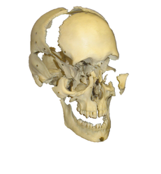 Exploded_Human_Skull PNG