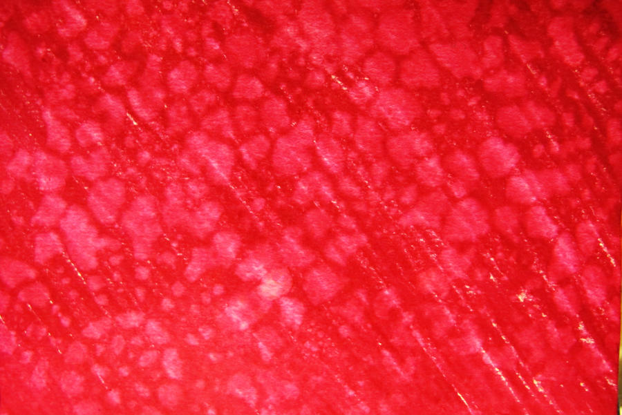 Blood Lace