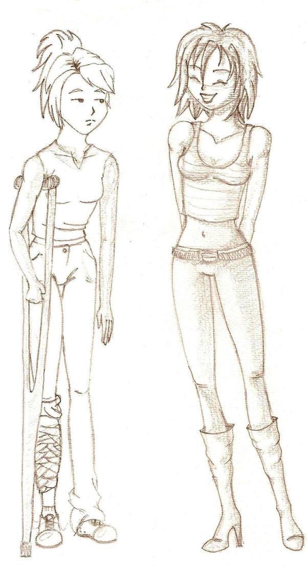 funny-looking broken leg by denatart on DeviantArt
