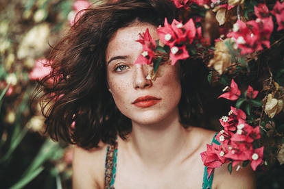Freckles