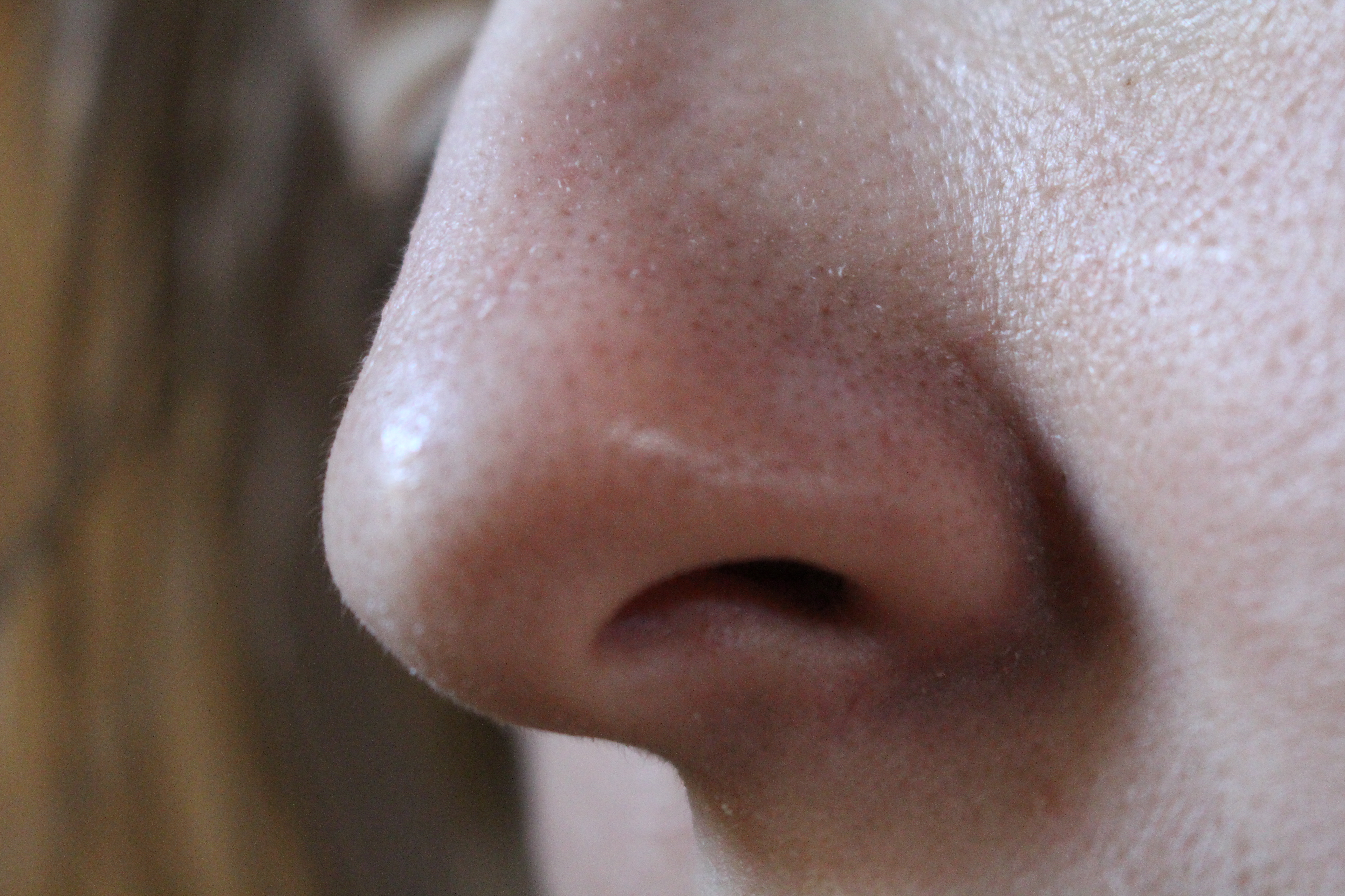 Anatomy Stock- Nose - Side Profile by Danika-Stock on DeviantArt Anatomy Stock- Nose - Side Profile by Danika-Stock on DeviantArt