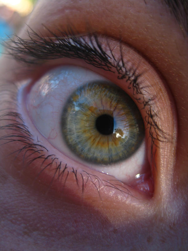 hazel eye