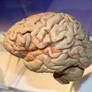 Denver Museum Anatomy Brain 235