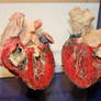 Denver Museum Anatomy Heart 237