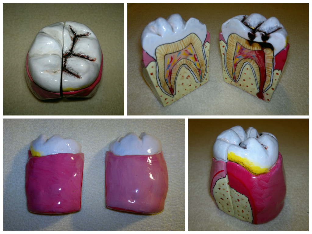 Painted clay tooth model by Kukucska on DeviantArt