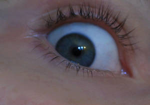 My eye