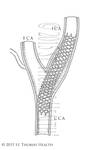 Blood Vessel Stent by LeccathuFurvicael