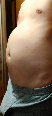 Bloated belly 6