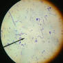 Streptococci