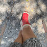 Red SLC with crutches