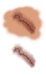 Wound [PNG]