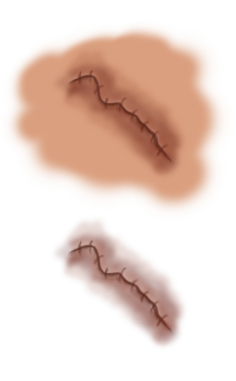 Wound [PNG]