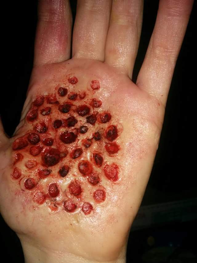 holes in hand