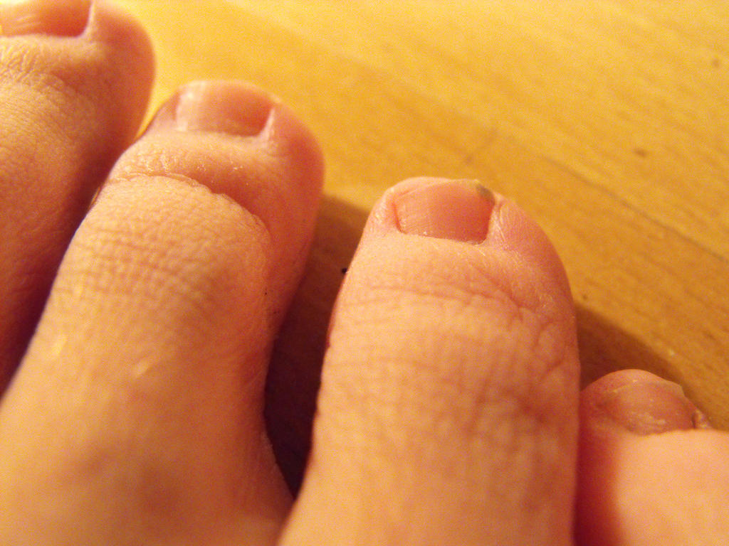 Toes 6 male By Davadiv On DeviantArt toes-6-male-by-davadiv-on-deviantart