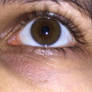 Photos- Eye