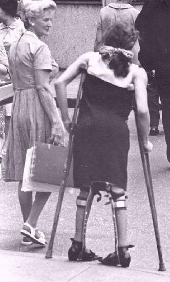 NYC Polio crutches+braces+twisted limbs by old-hous on DeviantArt