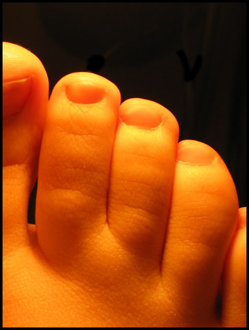 Toes