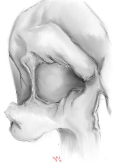 Skull