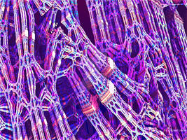 Iron fibers