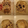 Conjoined Human Skull 2
