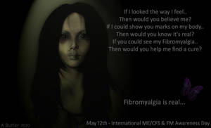 The Truth about Fibromyalgia