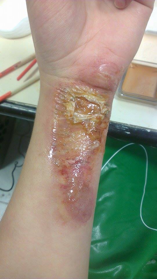 Burn makeup with latex