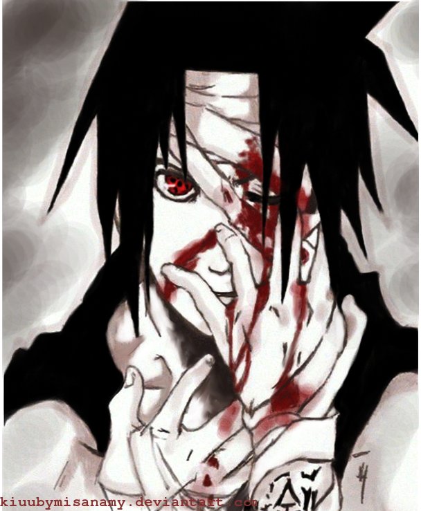 Here is itachi uchiha's eyes bleeding from use of its awesome power. 