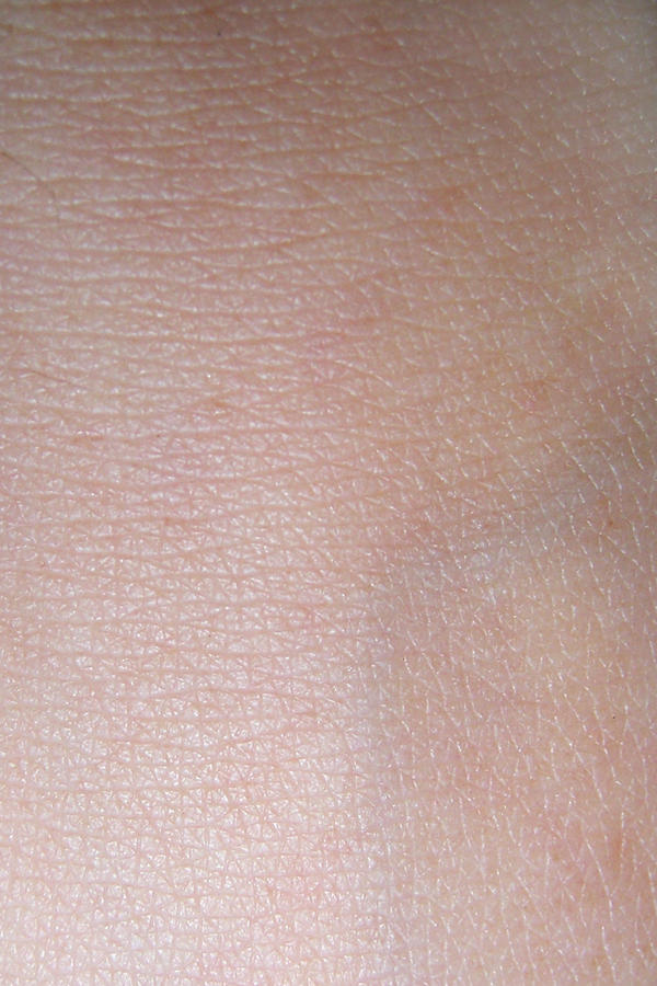 Skin texture III by KW-stock on DeviantArt