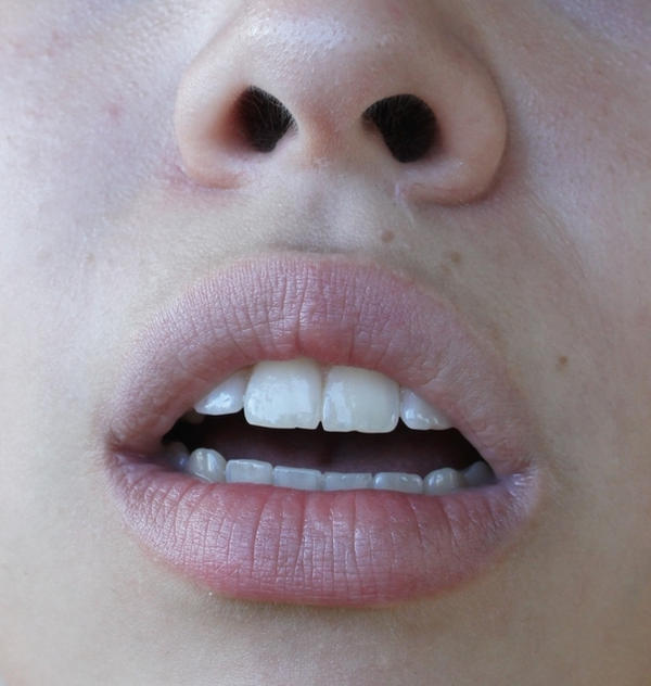 Mouth XX