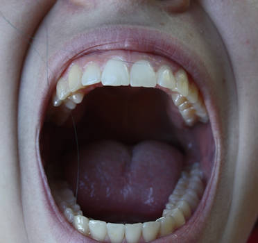 Mouth XXXXXIII