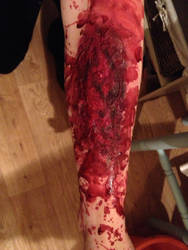 Practice Wound.