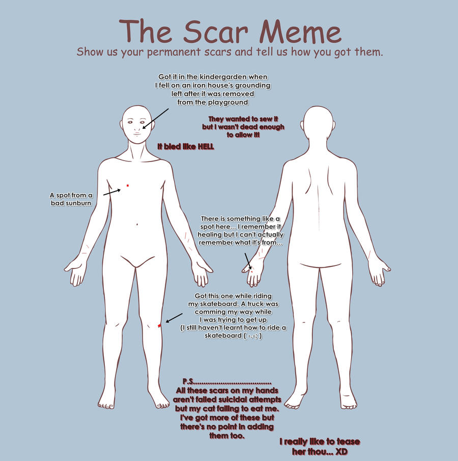 The Scar Meme