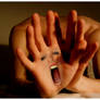 Migraine