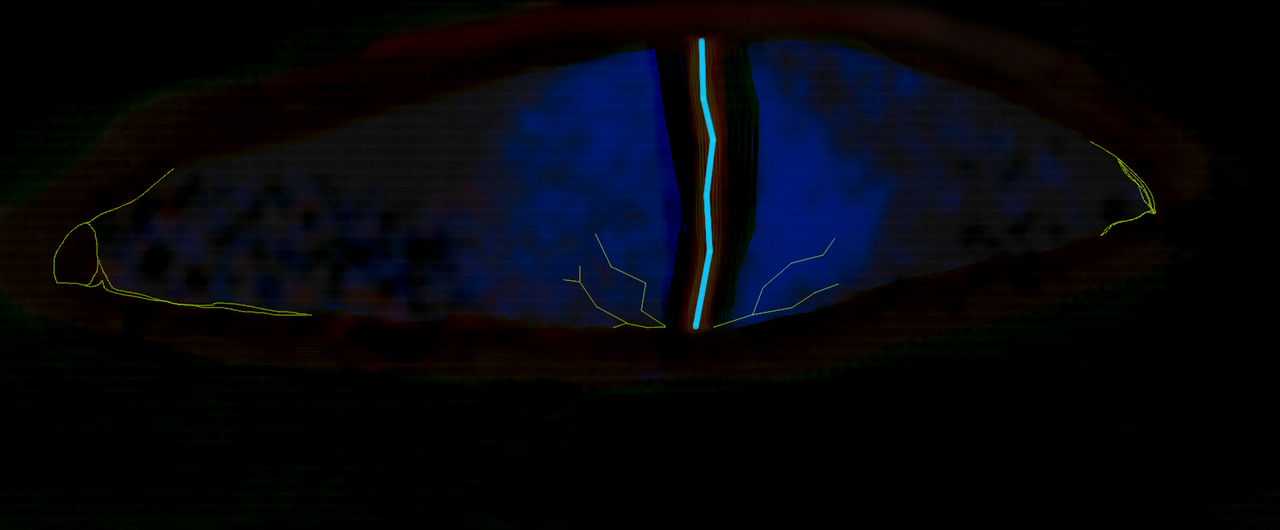 Angel Eye Rage Angel Eye by Sivtree on DeviantArt