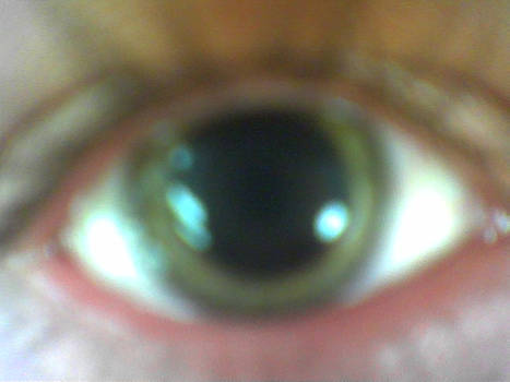 My Eye