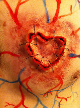 A Stitched Up Heart